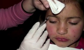 Și-a injectat fetița de doar opt ani cu botox. Care este explicația mamei?